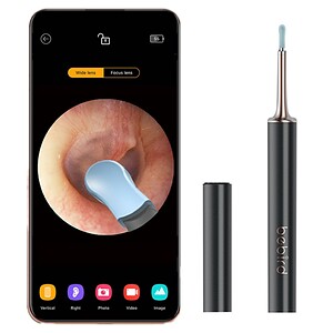 Flexible endoscope camera on smartphone displaying ear inspection, veterinary or medical diagnostic device, portable ear cleaning probe for ENT health, digital ear examination tool.
